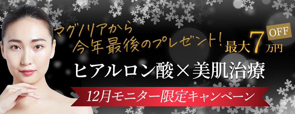 12月のキャンペーンバナー