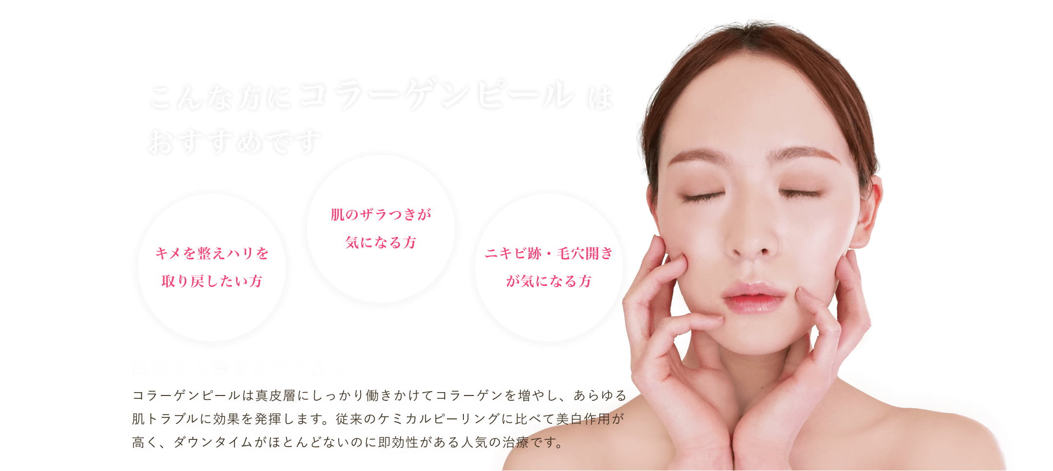 コラーゲンピール 東京 渋谷 美容皮膚科 マグノリア皮膚科クリニック